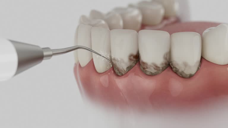 Trusted Teeth Cleaning And Checkup service in Harlem, GA - Dentist Open Now